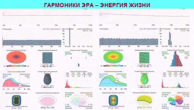 Гармоники ЭРА