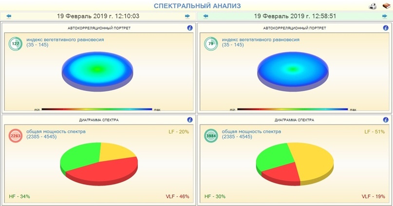 Примеры прослушивания ГАРМОНИК ЭРА: спектральный анализ