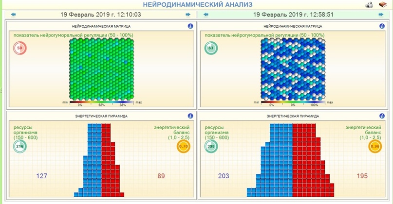 Примеры прослушивания ГАРМОНИК ЭРА: нейродинамический анализ