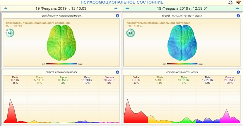 Примеры прослушивания ГАРМОНИК ЭРА: психоэмоциональное состояние