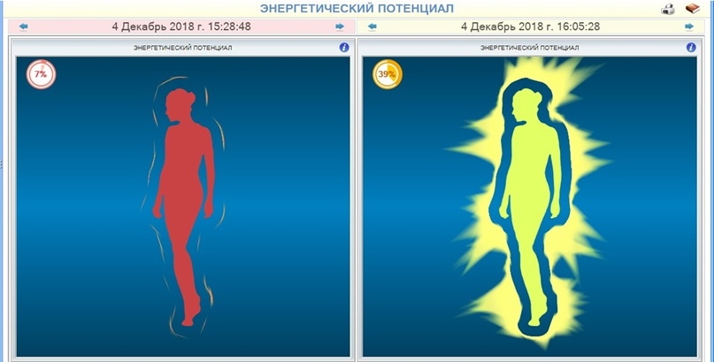 Примеры прослушивания ГАРМОНИК ЭРА: энергетический потенциал
